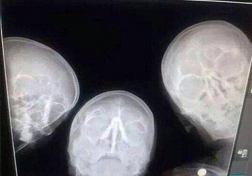 селфи рентгенологов.jpg